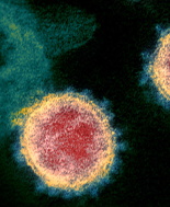 Covid-19, Il trattamento con anticorpi monoclonali può favorire la mutazione di SARS-CoV-2